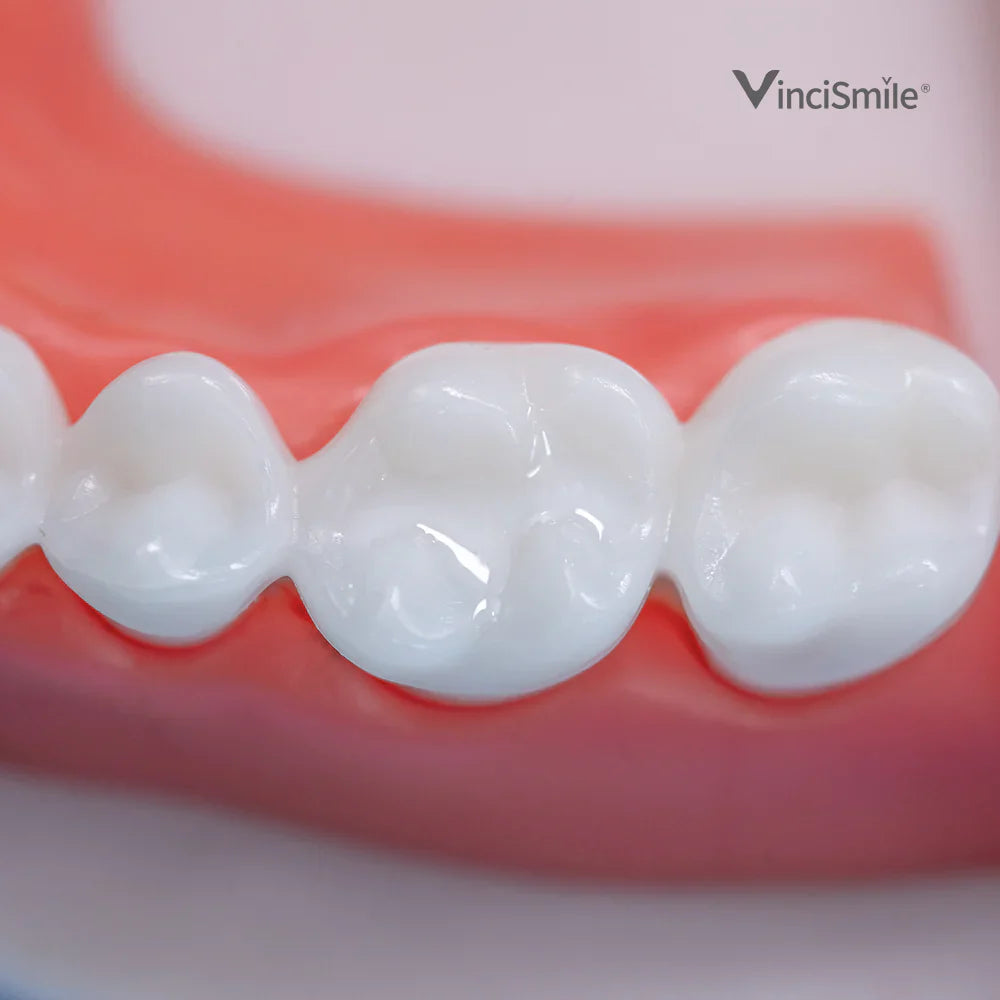 Proseal F Enamel Coating Resin x1 seringue - VINCISMILE - Dental Coop