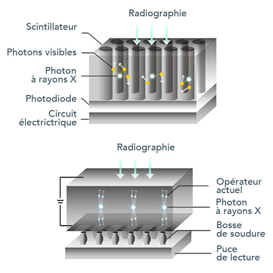 Capteur intra-oral X-ray sensor - XPECT VISION - uofti.com