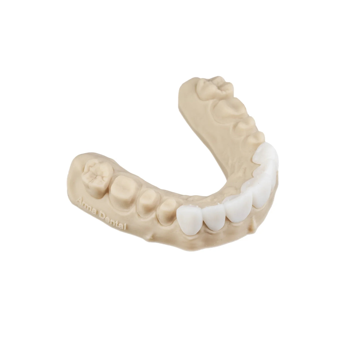 Résine 3D longue durée pour bridges implantaires provisoires 1kg - TEMP ULTRA - ArmaResin - uofti.com