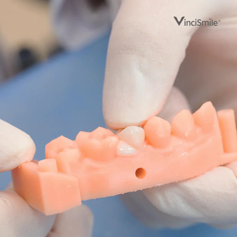 TopCEM Dual Cure Resin Cement x1 seringue - VINCISMILE
