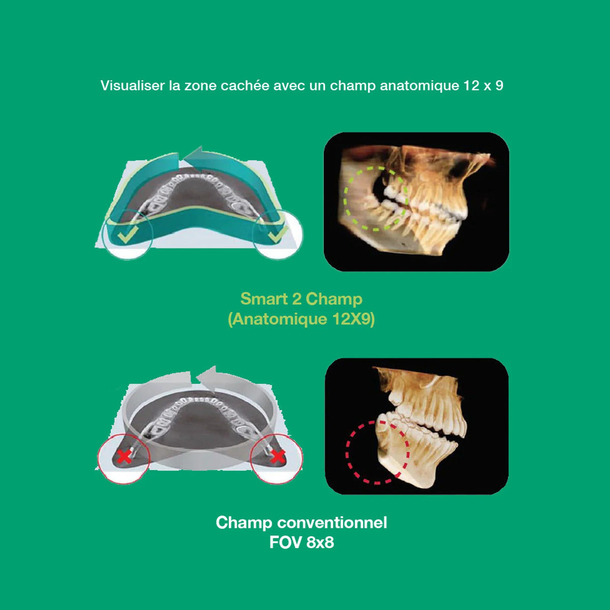 Système d’imagerie CT & panoramique 3D / 2D - Smart 2 - Vatech - uofti.com