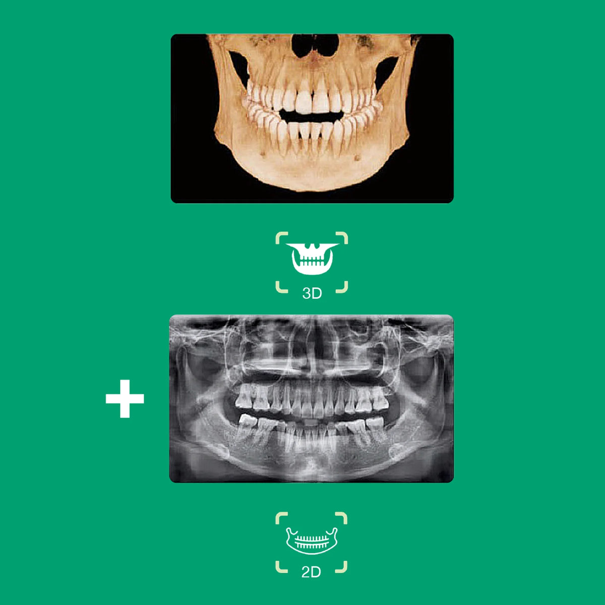 Système d’imagerie CT & panoramique 3D / 2D - Smart 2 - Vatech - uofti.com