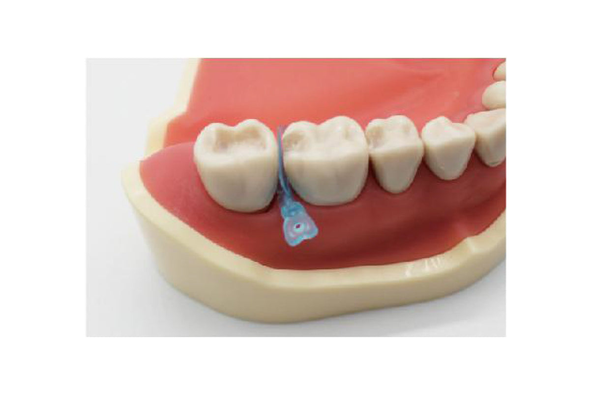 Boîte de 50 cales, coins / matrices interdentaires en plastique 2 en 1 - uofti.com