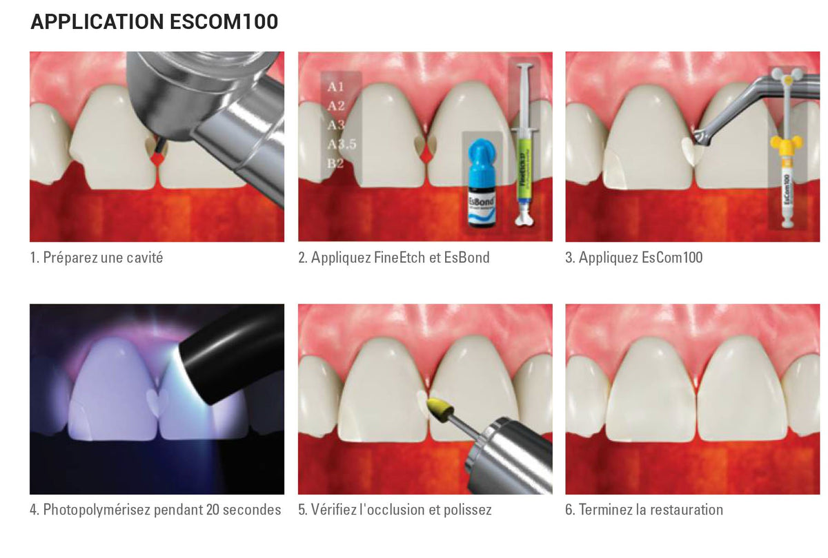 EsCom100 - A1 - 1x 4g Résine composite nano-hybride restauratrice photopolymérisable - uofti.com