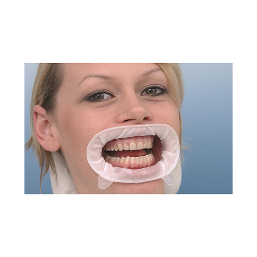 OptraGate Ecarteur flexible - Ivoclar Vivadent - uofti.com