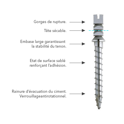 Europosts Titane Screw Post - Anthogyr