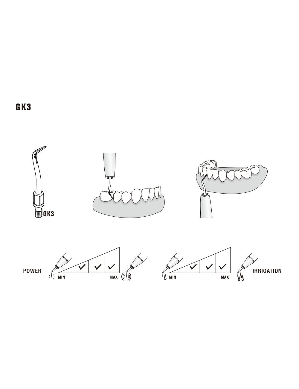 Insert GK3 compatible KAVO - WOODPECKER - uofti.com