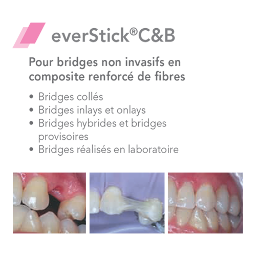 EverStick C&B Fibre de verre - GC