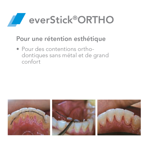 EverStick ORTHO Glasvezel - GC