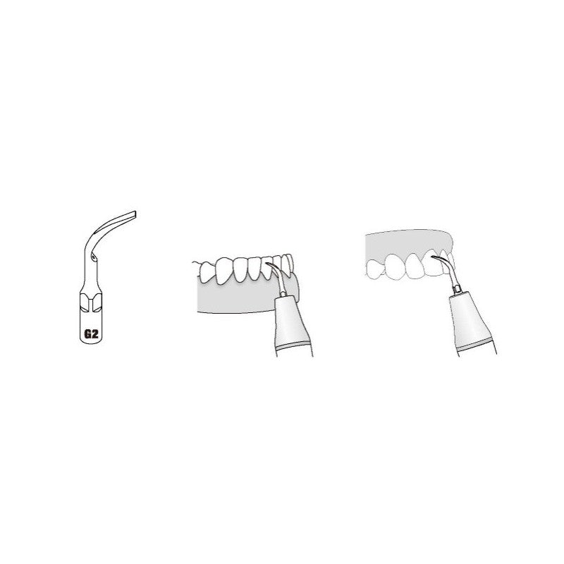 Insert GD2 compatible Satelec ultrarésistant UR - WOODPECKER - uofti.com