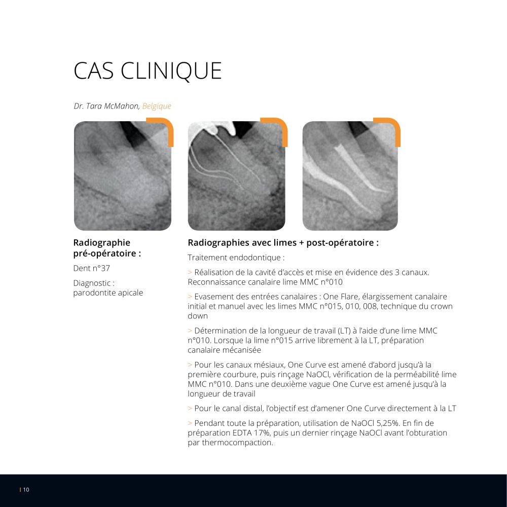 Lot de 6 limes One Curve - 4% conicité MicroMega - Dental Coop