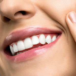 Blanchiment des dents