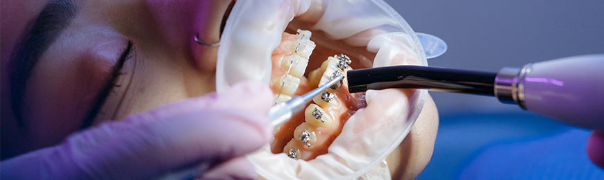 Instruments orthodontie
