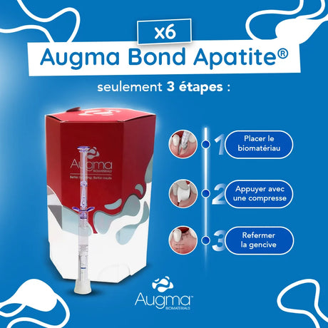 boite 6x Bond Apatite™ comblement osseux instantané par Augma Biomaterials™ - uofti.com