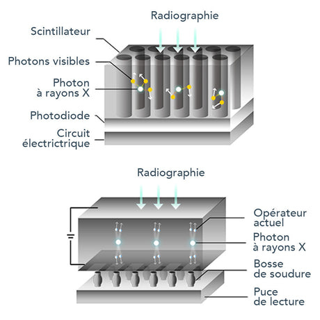Capteur intra-oral X-ray sensor - XPECT VISION - uofti.com