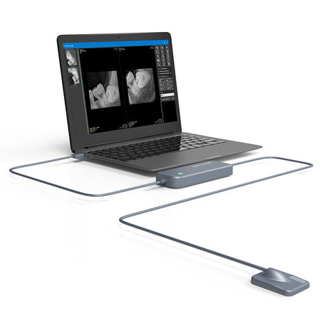 Capteur intra-oral X-ray sensor - XPECT VISION - uofti.com