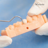 TopCEM Dual Cure Resin Cement x1 seringue - VINCISMILE