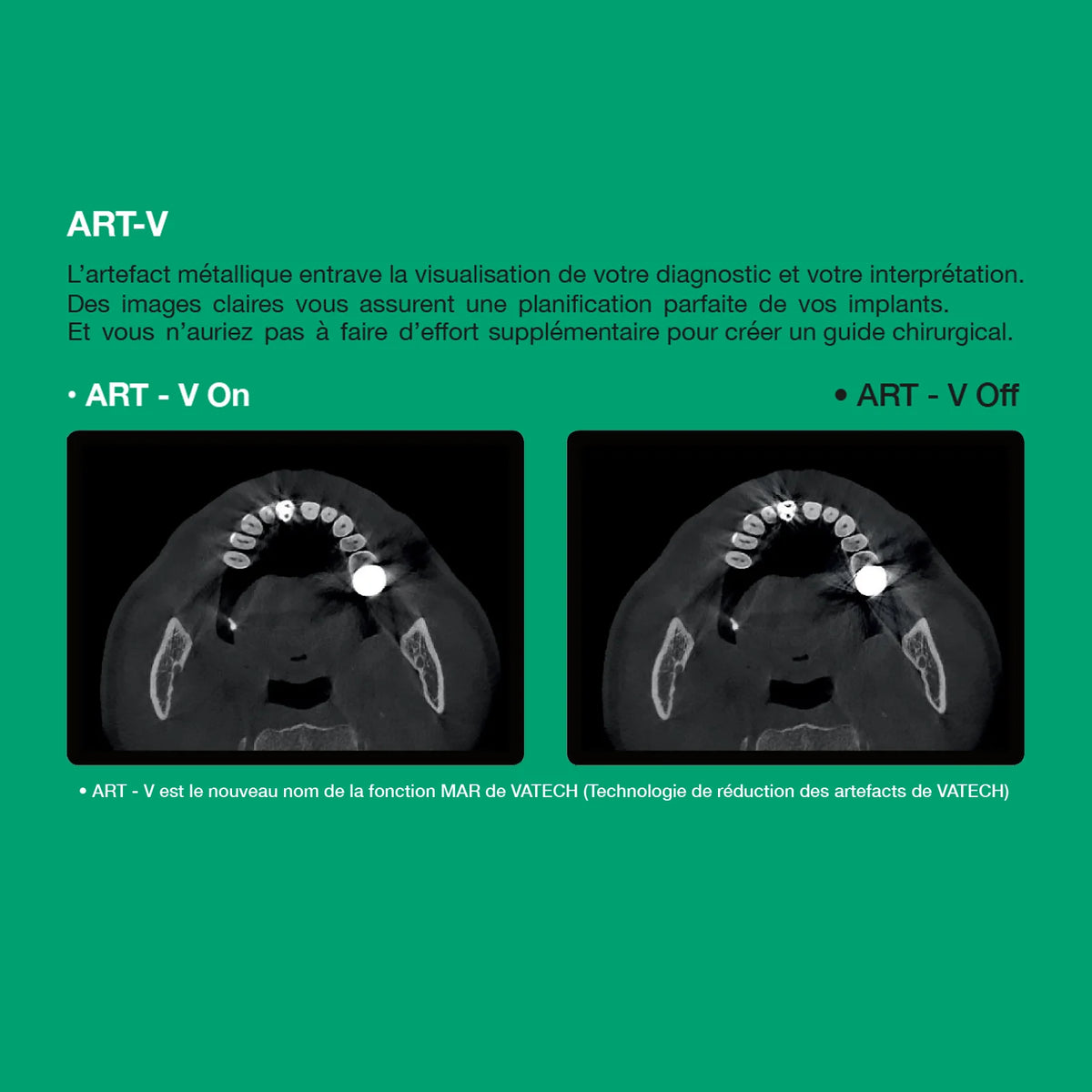 Système d’imagerie 4-en-1 3D / 2D - Green 2 - Vatech - uofti.com