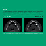 Système d’imagerie 4-en-1 3D / 2D - Green 2 - Vatech - uofti.com
