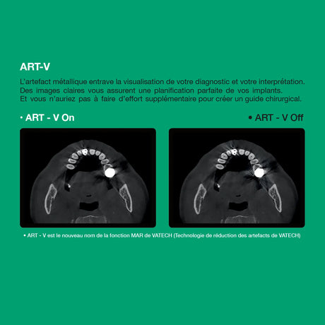Système d’imagerie 4-en-1 3D / 2D - Green 2 - Vatech - uofti.com