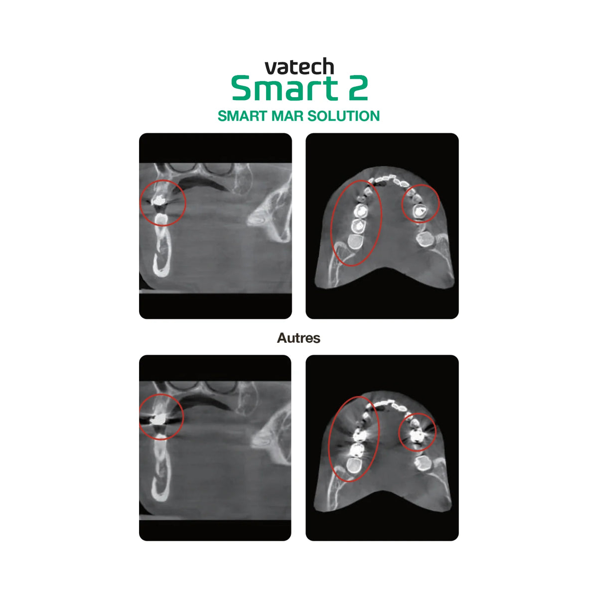 Système d’imagerie CT & panoramique 3D / 2D - Smart 2 - Vatech - uofti.com