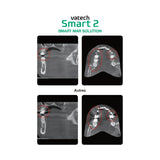 Système d’imagerie CT & panoramique 3D / 2D - Smart 2 - Vatech - uofti.com