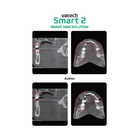 Système d’imagerie CT & panoramique 3D / 2D - Smart 2 - Vatech - uofti.com