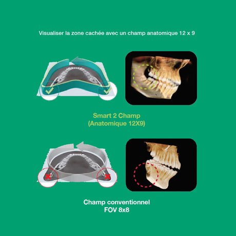 Système d’imagerie CT & panoramique 3D / 2D - Smart 2 - Vatech - uofti.com