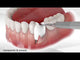 6 Bond Apatite™  - boîte de 6  | Augma Biomaterials™ + Conférences Augma™ Day 2026 (Copie)