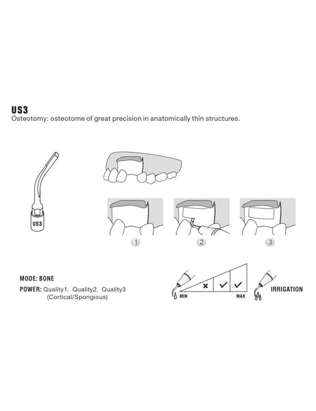 Insert US3 pour chirurgie piezo - WOODPECKER - uofti.com