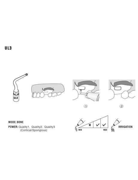 Insert UL3 pour chirurgie piezo - WOODPECKER - uofti.com