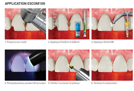 Lot de 20 capsules de 0,25g EsCom100 - B2 - Résine composite nano-hybride restauratrice photopolymérisable - uofti.com
