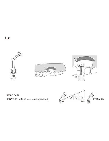 Insert UL2 pour chirurgie piezo - WOODPECKER - uofti.com