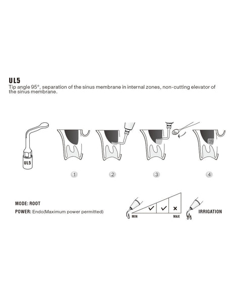 Insert UL5 pour chirurgie piezo - WOODPECKER - uofti.com