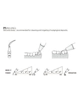 Insert P1 compatible EMS ultrarésistant UR - WOODPECKER - uofti.com