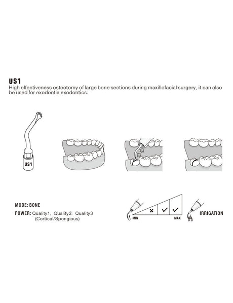Insert US1 pour chirurgie piezo - WOODPECKER - uofti.com