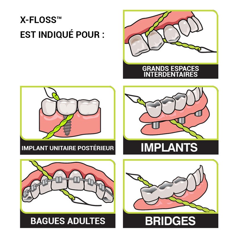 X-Floss - uofti.com