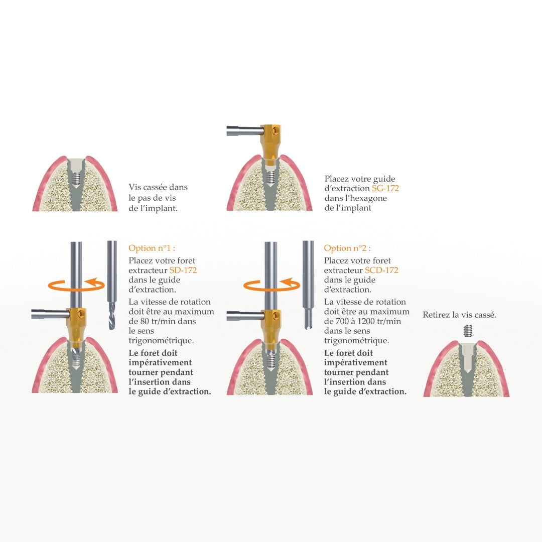 SOS Kit - Extraction rapide & sécurisée de vis d’implant cassées par Safe Implant - uofti.com