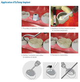 EsTemp Implant 1x 8g Ciment temporaire à base de résine sans eugénol pour les couronnes retenues par implants - uofti.com