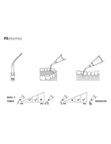 Insert P3 compatible EMS  ultrarésistant UR - WOODPECKER - uofti.com
