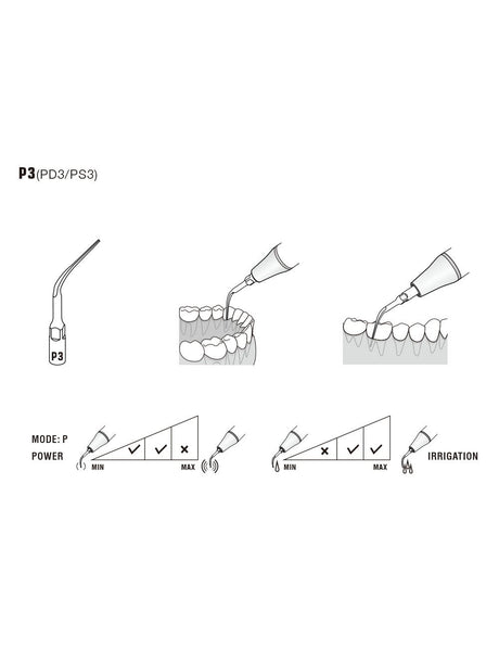 Insert P3 compatible EMS  ultrarésistant UR - WOODPECKER - uofti.com