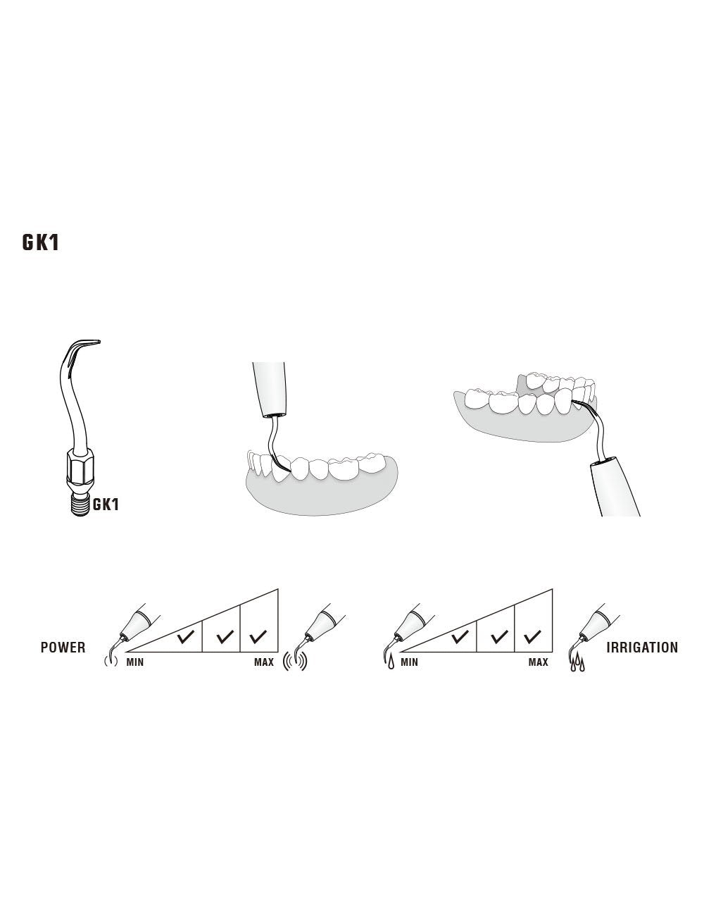 Insert GK1 compatible KAVO  UltraResistant UR - WOODPECKER - uofti.com