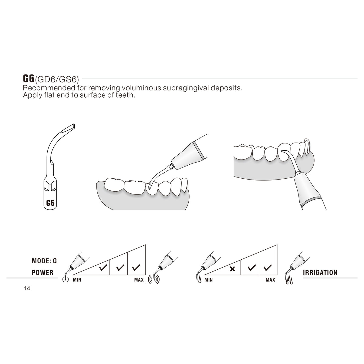 Insert G6 compatible EMS ultrarésistant UR - WOODPECKER - uofti.com