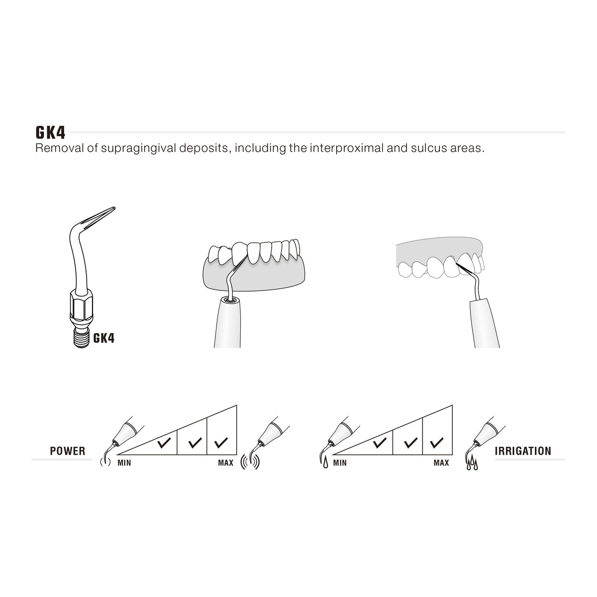 Insert GK4 compatible KAVO UltraResistant UR - uofti.com