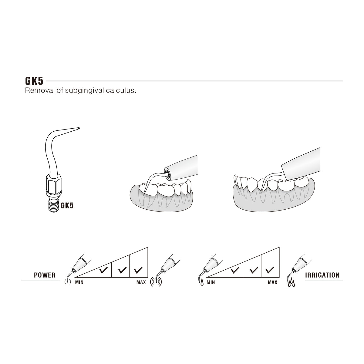 Insert GK5 compatible KAVO UltraResistant UR - uofti.com