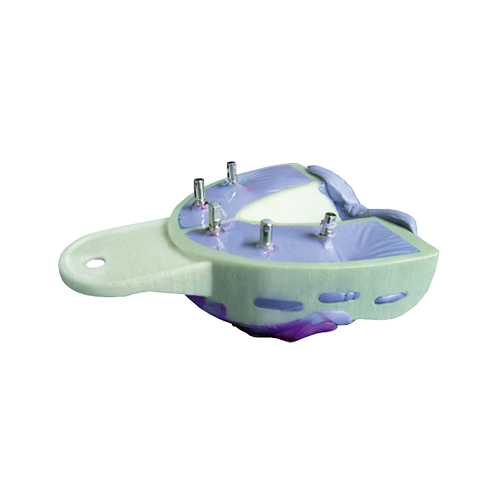 Miratray Implant Impression Tray - Hager &amp; Werken