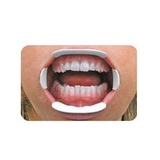 Optiview Ecarteur labial et jugal - Kerr - uofti.com