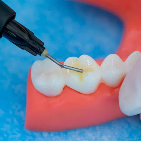TrusFIL-Flow - Composite de restauration fluide - 2 g/seringue - HUGE - TrusFIL-Flow - Composite de restauration fluide - 2 g/seringue - HUGE - uofti.com