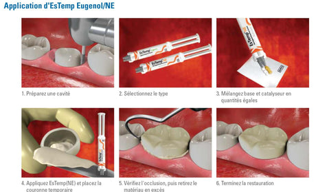 EsTemp Eugenol 2x 10g Ciment temporaire pour couronnes et bridges temporaires - uofti.com