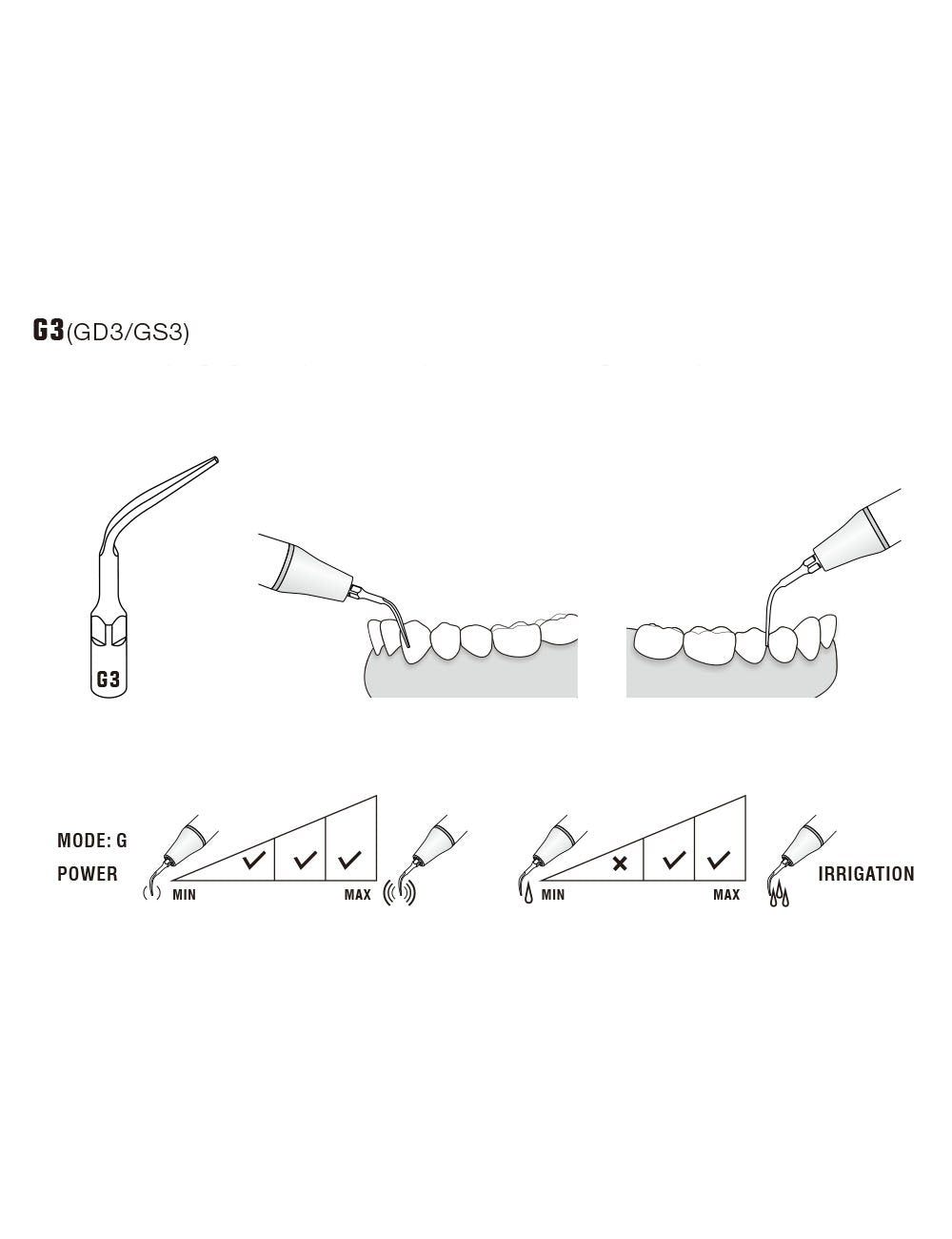 Insert G3 compatible EMS ultrarésistant UR - WOODPECKER - uofti.com